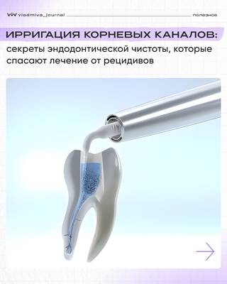 Ирригация каналов: баланс традиций и инноваций.